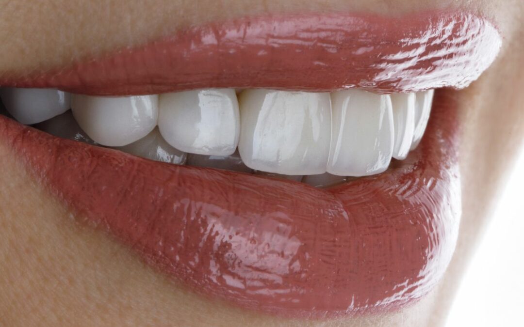 Servizio di Estetica Dentale di Life Clinique: eccellenza ed innovazione