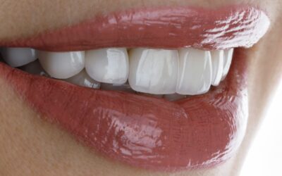 Servizio di Estetica Dentale di Life Clinique: eccellenza ed innovazione