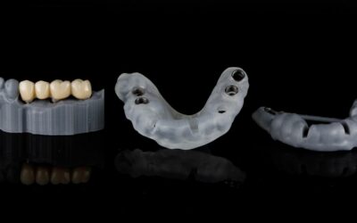 I vantaggi dell’implantologia a carico immediato: una soluzione efficace e veloce