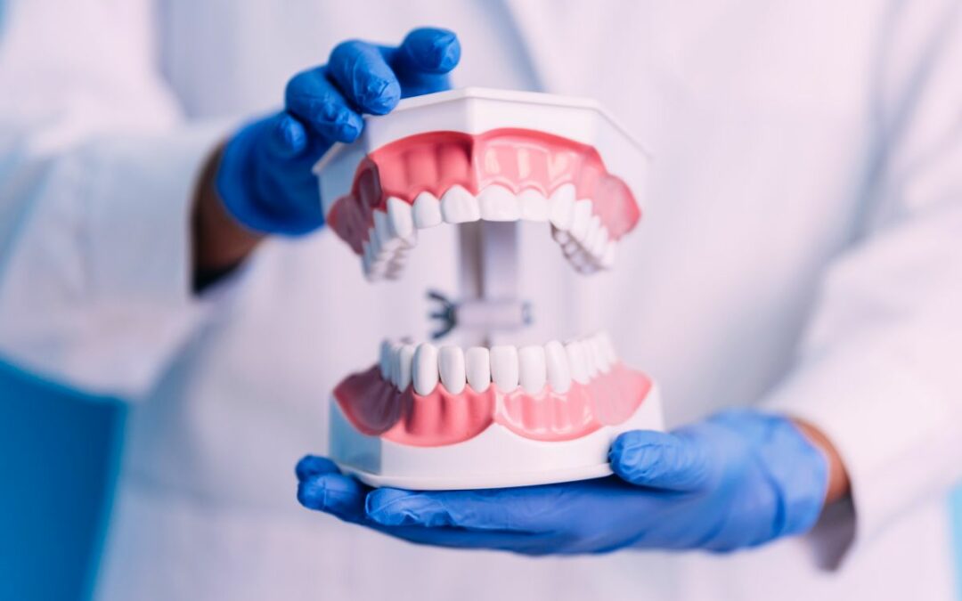 Denti fissi in un giorno, come funziona la tecnica All-on-4